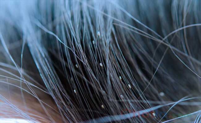 ngủ mơ thấy con chấy đánh con gì chắc thắng ngủ mơ thấy con chấy đánh con gì chắc thắng