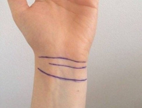 Đường vân số 3 này chỉ có 20% dân số có được